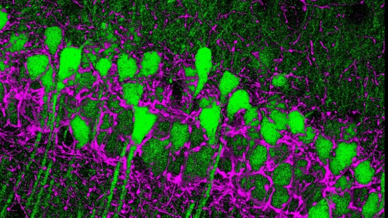 Mikroskopische Aufnahme von Cannabinoid-Rezeptoren im Hippocampus, zeigt neuronale Verbindungen